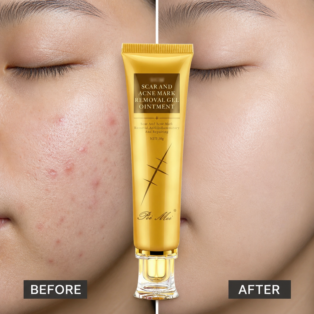 Crème Anti-Acné Rapide