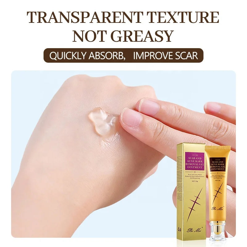 Crème Anti-Acné Rapide
